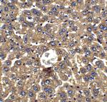 DRAM Antibody in Immunohistochemistry (Paraffin) (IHC (P))