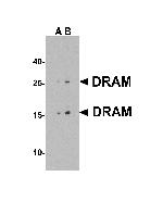DRAM Antibody in Western Blot (WB)