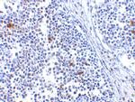 MDA5 Antibody in Immunohistochemistry (IHC)