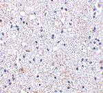 SCO1 Antibody in Immunohistochemistry (IHC)