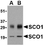 SCO1 Antibody in Western Blot (WB)