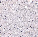 TIGAR Polyclonal Antibody