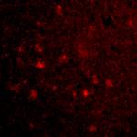 MAVS Polyclonal Antibody