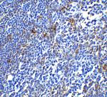 PD-1 Antibody in Immunohistochemistry (Paraffin) (IHC (P))