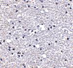 PD-1 Antibody in Immunohistochemistry (IHC)