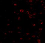 BRSK1 Polyclonal Antibody