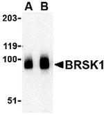 BRSK1 Antibody in Western Blot (WB)