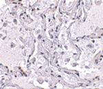 TEP1 Antibody in Immunohistochemistry (IHC)