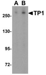 TEP1 Antibody in Western Blot (WB)