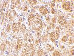 DARC Polyclonal Antibody