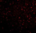 STK29 Polyclonal Antibody