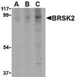 STK29 Antibody in Western Blot (WB)