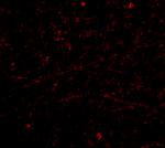 DARC Antibody in Immunocytochemistry (ICC/IF)