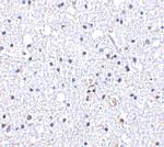 DARC Antibody in Immunohistochemistry (IHC)