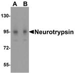 Neurotrypsin Antibody in Western Blot (WB)