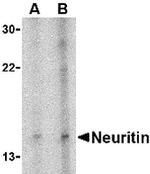 Neuritin Antibody in Western Blot (WB)