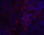 STIM1 Polyclonal Antibody