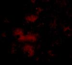 STIM2 Polyclonal Antibody