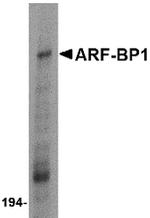 HUWE1 Antibody in Western Blot (WB)
