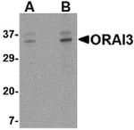 ORAI3 Antibody in Western Blot (WB)