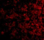 TSLP Receptor Polyclonal Antibody