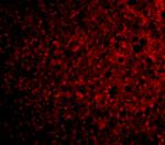 TSLP Receptor Polyclonal Antibody