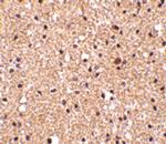 Stathmin 1 Polyclonal Antibody