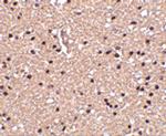 Stathmin 1 Polyclonal Antibody