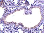 SLPI Polyclonal Antibody