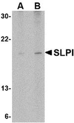 SLPI Antibody in Western Blot (WB)