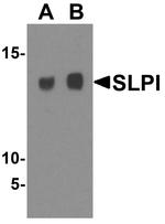 SLPI Antibody in Western Blot (WB)