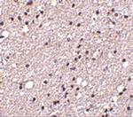 TACR3 Polyclonal Antibody