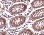 MICA Polyclonal Antibody