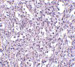 Carabin Polyclonal Antibody