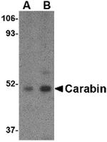 Carabin Antibody in Western Blot (WB)