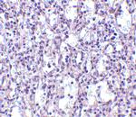 Carabin Polyclonal Antibody