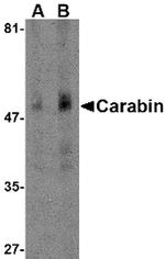 Carabin Antibody in Western Blot (WB)