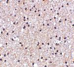 MORF4 Antibody in Immunohistochemistry (IHC)
