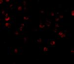 ADAP Antibody in Immunocytochemistry (ICC/IF)