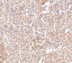 STEAP1 Polyclonal Antibody