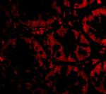 STEAP2 Polyclonal Antibody