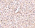 STEAP3 Antibody in Immunohistochemistry (IHC)