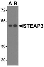 STEAP3 Antibody in Western Blot (WB)