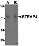 STEAP4 Polyclonal Antibody