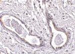 ABRA1 Polyclonal Antibody