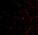 RAP80 Polyclonal Antibody