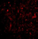 RAP80 Antibody in Immunohistochemistry (IHC)