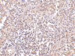 RAP80 Polyclonal Antibody