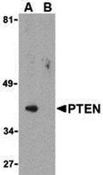 PTEN Polyclonal Antibody