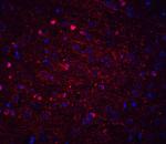 Kinesin 5A Antibody in Immunohistochemistry (IHC)